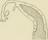 Picture 144 of 231 from Obstetrics : a text-book for the use of students and practitioners / by J. Whitridge Williams ... with eight coloured plates and six hundred and thirty illustrations in the text. (1903), leaf 521