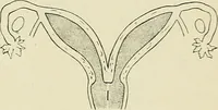 Picture 146 of 231 from Obstetrics : a text-book for the use of students and practitioners / by J. Whitridge Williams ... with eight coloured plates and six hundred and thirty illustrations in the text. (1903), leaf 521