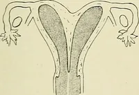 Picture 147 of 231 from Obstetrics : a text-book for the use of students and practitioners / by J. Whitridge Williams ... with eight coloured plates and six hundred and thirty illustrations in the text. (1903), leaf 521