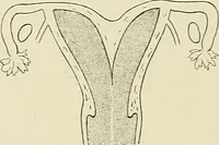 Picture 148 of 231 from Obstetrics : a text-book for the use of students and practitioners / by J. Whitridge Williams ... with eight coloured plates and six hundred and thirty illustrations in the text. (1903), leaf 521