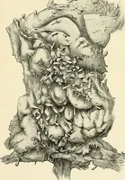 An illustration from Obstetrics : a text-book for the use of students and practitioners / by J. Whitridge Williams ... with eight coloured plates and six hundred and thirty illustrations in the text. (1903)
