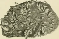 An illustration from Obstetrics : a text-book for the use of students and practitioners / by J. Whitridge Williams ... with eight coloured plates and six hundred and thirty illustrations in the text. (1903)