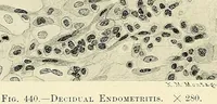 Picture 151 of 231 from Obstetrics : a text-book for the use of students and practitioners / by J. Whitridge Williams ... with eight coloured plates and six hundred and thirty illustrations in the text. (1903), leaf 534