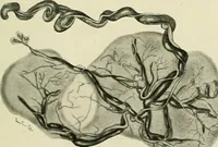 An illustration from Obstetrics : a text-book for the use of students and practitioners / by J. Whitridge Williams ... with eight coloured plates and six hundred and thirty illustrations in the text. (1903)