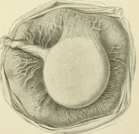 An illustration from Obstetrics : a text-book for the use of students and practitioners / by J. Whitridge Williams ... with eight coloured plates and six hundred and thirty illustrations in the text. (1903)