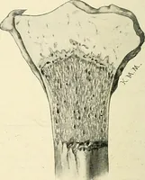 Picture 158 of 231 from Obstetrics : a text-book for the use of students and practitioners / by J. Whitridge Williams ... with eight coloured plates and six hundred and thirty illustrations in the text. (1903), leaf 566