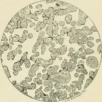 An illustration from Obstetrics : a text-book for the use of students and practitioners / by J. Whitridge Williams ... with eight coloured plates and six hundred and thirty illustrations in the text. (1903)