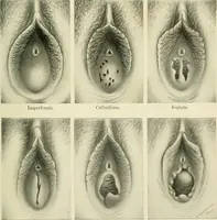 Picture 18 of 231 from Obstetrics : a text-book for the use of students and practitioners / by J. Whitridge Williams ... with eight coloured plates and six hundred and thirty illustrations in the text. (1903), leaf 57
