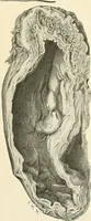 An illustration from Obstetrics : a text-book for the use of students and practitioners / by J. Whitridge Williams ... with eight coloured plates and six hundred and thirty illustrations in the text. (1903)