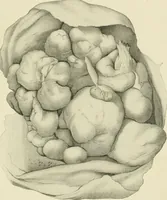 An illustration from Obstetrics : a text-book for the use of students and practitioners / by J. Whitridge Williams ... with eight coloured plates and six hundred and thirty illustrations in the text. (1903)