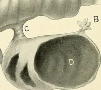 Picture 165 of 231 from Obstetrics : a text-book for the use of students and practitioners / by J. Whitridge Williams ... with eight coloured plates and six hundred and thirty illustrations in the text. (1903), leaf 588