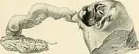 An illustration from Obstetrics : a text-book for the use of students and practitioners / by J. Whitridge Williams ... with eight coloured plates and six hundred and thirty illustrations in the text. (1903)