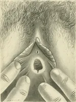 Picture 20 of 231 from Obstetrics : a text-book for the use of students and practitioners / by J. Whitridge Williams ... with eight coloured plates and six hundred and thirty illustrations in the text. (1903), leaf 60