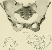 Picture 178 of 231 from Obstetrics : a text-book for the use of students and practitioners / by J. Whitridge Williams ... with eight coloured plates and six hundred and thirty illustrations in the text. (1903), leaf 653