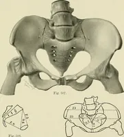 Picture 179 of 231 from Obstetrics : a text-book for the use of students and practitioners / by J. Whitridge Williams ... with eight coloured plates and six hundred and thirty illustrations in the text. (1903), leaf 657