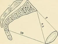 Picture 180 of 231 from Obstetrics : a text-book for the use of students and practitioners / by J. Whitridge Williams ... with eight coloured plates and six hundred and thirty illustrations in the text. (1903), leaf 658