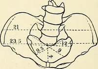 An illustration from Obstetrics : a text-book for the use of students and practitioners / by J. Whitridge Williams ... with eight coloured plates and six hundred and thirty illustrations in the text. (1903)