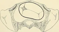 An illustration from Obstetrics : a text-book for the use of students and practitioners / by J. Whitridge Williams ... with eight coloured plates and six hundred and thirty illustrations in the text. (1903)