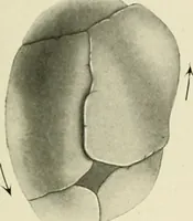 Picture 194 of 231 from Obstetrics : a text-book for the use of students and practitioners / by J. Whitridge Williams ... with eight coloured plates and six hundred and thirty illustrations in the text. (1903), leaf 679