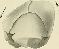 An illustration from Obstetrics : a text-book for the use of students and practitioners / by J. Whitridge Williams ... with eight coloured plates and six hundred and thirty illustrations in the text. (1903)