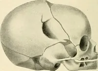 An illustration from Obstetrics : a text-book for the use of students and practitioners / by J. Whitridge Williams ... with eight coloured plates and six hundred and thirty illustrations in the text. (1903)