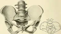 Picture 198 of 231 from Obstetrics : a text-book for the use of students and practitioners / by J. Whitridge Williams ... with eight coloured plates and six hundred and thirty illustrations in the text. (1903), leaf 696