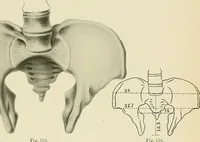 Picture 201 of 231 from Obstetrics : a text-book for the use of students and practitioners / by J. Whitridge Williams ... with eight coloured plates and six hundred and thirty illustrations in the text. (1903), leaf 701