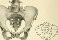 Picture 203 of 231 from Obstetrics : a text-book for the use of students and practitioners / by J. Whitridge Williams ... with eight coloured plates and six hundred and thirty illustrations in the text. (1903), leaf 704