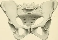 Picture 204 of 231 from Obstetrics : a text-book for the use of students and practitioners / by J. Whitridge Williams ... with eight coloured plates and six hundred and thirty illustrations in the text. (1903), leaf 704