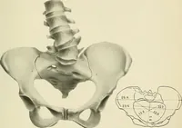 Picture 209 of 231 from Obstetrics : a text-book for the use of students and practitioners / by J. Whitridge Williams ... with eight coloured plates and six hundred and thirty illustrations in the text. (1903), leaf 715