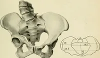 Picture 211 of 231 from Obstetrics : a text-book for the use of students and practitioners / by J. Whitridge Williams ... with eight coloured plates and six hundred and thirty illustrations in the text. (1903), leaf 717