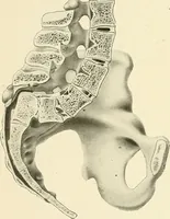 Picture 212 of 231 from Obstetrics : a text-book for the use of students and practitioners / by J. Whitridge Williams ... with eight coloured plates and six hundred and thirty illustrations in the text. (1903), leaf 718