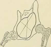 An illustration from Obstetrics : a text-book for the use of students and practitioners / by J. Whitridge Williams ... with eight coloured plates and six hundred and thirty illustrations in the text. (1903)