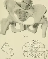 Picture 218 of 231 from Obstetrics : a text-book for the use of students and practitioners / by J. Whitridge Williams ... with eight coloured plates and six hundred and thirty illustrations in the text. (1903), leaf 727