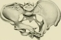 An illustration from Obstetrics : a text-book for the use of students and practitioners / by J. Whitridge Williams ... with eight coloured plates and six hundred and thirty illustrations in the text. (1903)