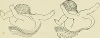 Picture 220 of 231 from Obstetrics : a text-book for the use of students and practitioners / by J. Whitridge Williams ... with eight coloured plates and six hundred and thirty illustrations in the text. (1903), leaf 745