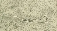 An illustration from Obstetrics : a text-book for the use of students and practitioners / by J. Whitridge Williams ... with eight coloured plates and six hundred and thirty illustrations in the text. (1903)