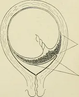 An illustration from Obstetrics : a text-book for the use of students and practitioners / by J. Whitridge Williams ... with eight coloured plates and six hundred and thirty illustrations in the text. (1903)