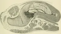 An illustration from Obstetrics : a text-book for the use of students and practitioners / by J. Whitridge Williams ... with eight coloured plates and six hundred and thirty illustrations in the text. (1903)