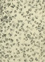 An illustration from Obstetrics : a text-book for the use of students and practitioners / by J. Whitridge Williams ... with eight coloured plates and six hundred and thirty illustrations in the text. (1903)