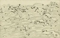Picture 231 of 231 from Obstetrics : a text-book for the use of students and practitioners / by J. Whitridge Williams ... with eight coloured plates and six hundred and thirty illustrations in the text. (1903), leaf 827