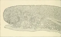 An illustration from Obstetrics : a text-book for the use of students and practitioners / by J. Whitridge Williams ... with eight coloured plates and six hundred and thirty illustrations in the text. (1903)