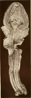 An illustration from A practical treatise on genito-urinary and venereal diseases and syphilis / By Robert W. Taylor. (1904)
