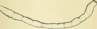 An illustration from A practical treatise on genito-urinary and venereal diseases and syphilis / By Robert W. Taylor. (1904)