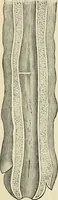 An illustration from A practical treatise on genito-urinary and venereal diseases and syphilis / By Robert W. Taylor. (1904)