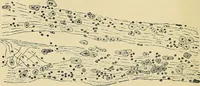 An illustration from A practical treatise on genito-urinary and venereal diseases and syphilis / By Robert W. Taylor. (1904)