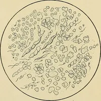 Picture 13 of 58 from A practical treatise on genito-urinary and venereal diseases and syphilis / By Robert W. Taylor. (1904), leaf 38