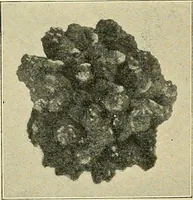 An illustration from A practical treatise on genito-urinary and venereal diseases and syphilis / By Robert W. Taylor. (1904)