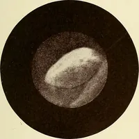 Picture 39 of 58 from A practical treatise on genito-urinary and venereal diseases and syphilis / By Robert W. Taylor. (1904), leaf 427