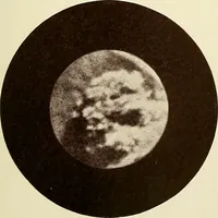 An illustration from A practical treatise on genito-urinary and venereal diseases and syphilis / By Robert W. Taylor. (1904)